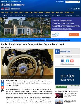 Study: Brain Implant Lets Paralyzed Man Regain Use of Hand