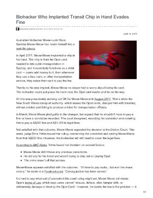 Biohacker Who Implanted Transit Chip in Hand Evades Fine