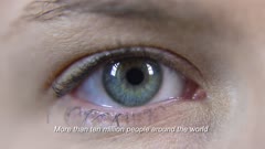 NEXT EYE Prosthesis